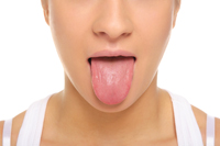 Tumore della lingua